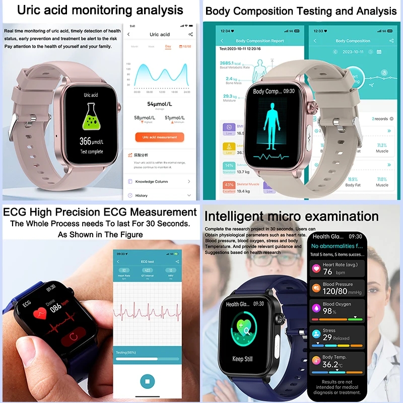2025 New For XIAOM1 ECG+PPG Bl - Smartwatch New Watches For Women avis et prix
