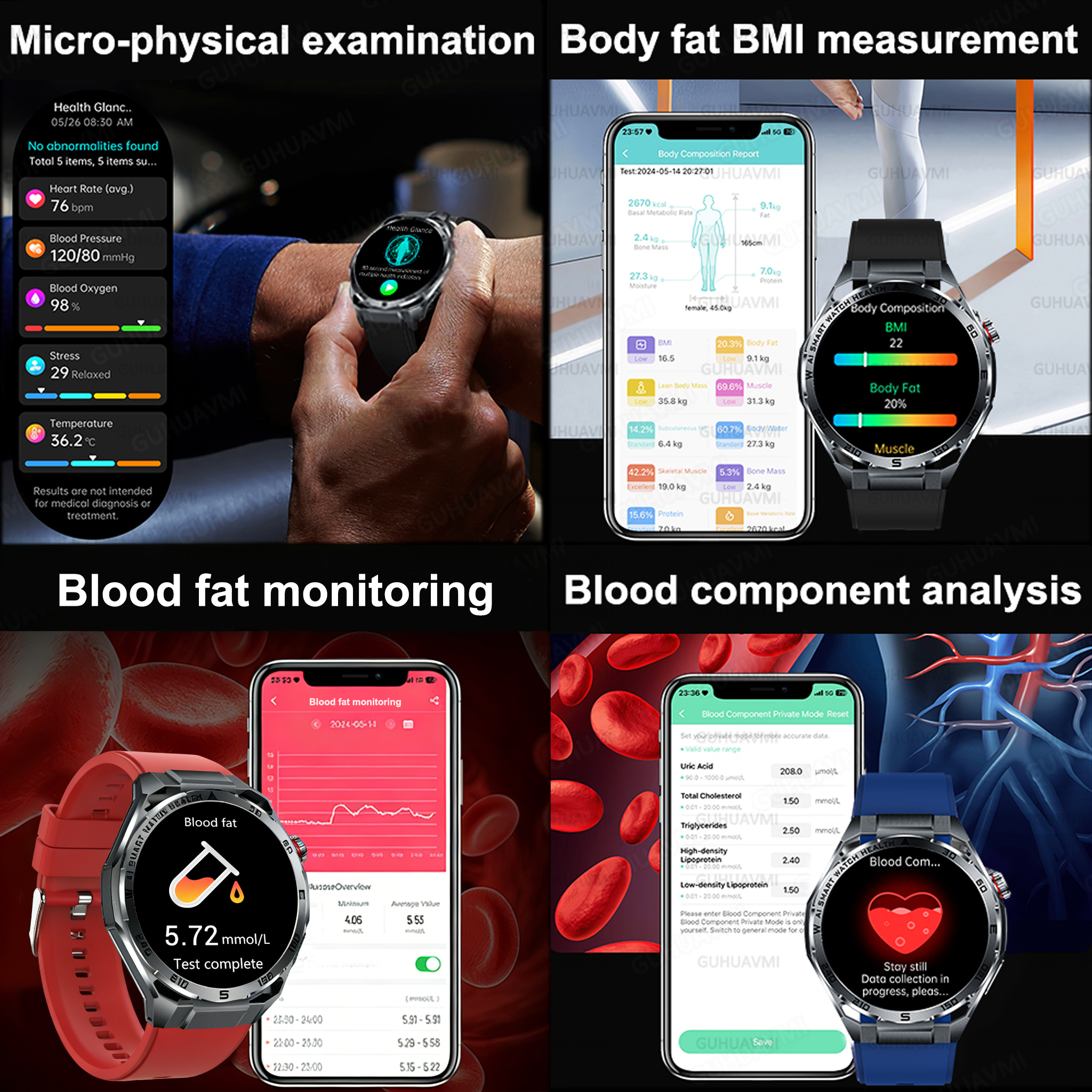 2026 New Body Fat AI Analysis  - Smartwatch New Watches For Women avis et prix