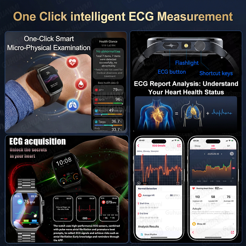 2026 New Accurate Diagnosis Sm - Smartwatch New Watches For Women avis et prix